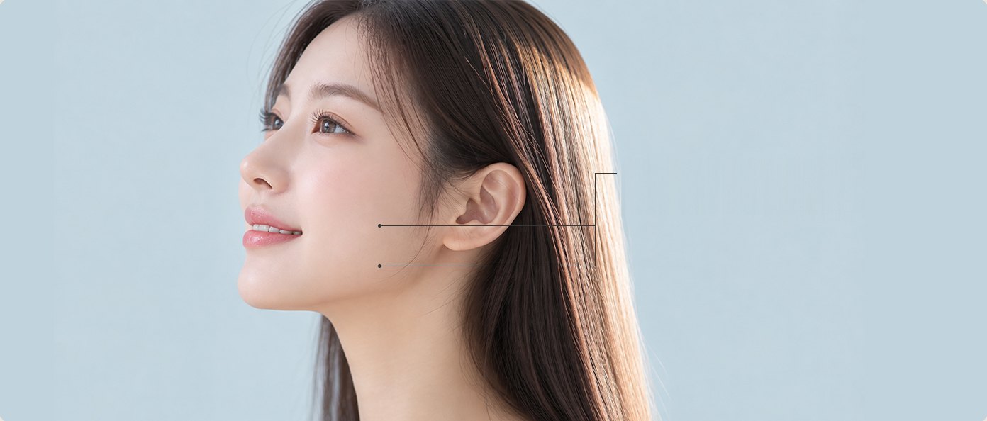 수술 부위 — 턱밑·턱선 두 곳을 점과 선으로 표시한 옆모습